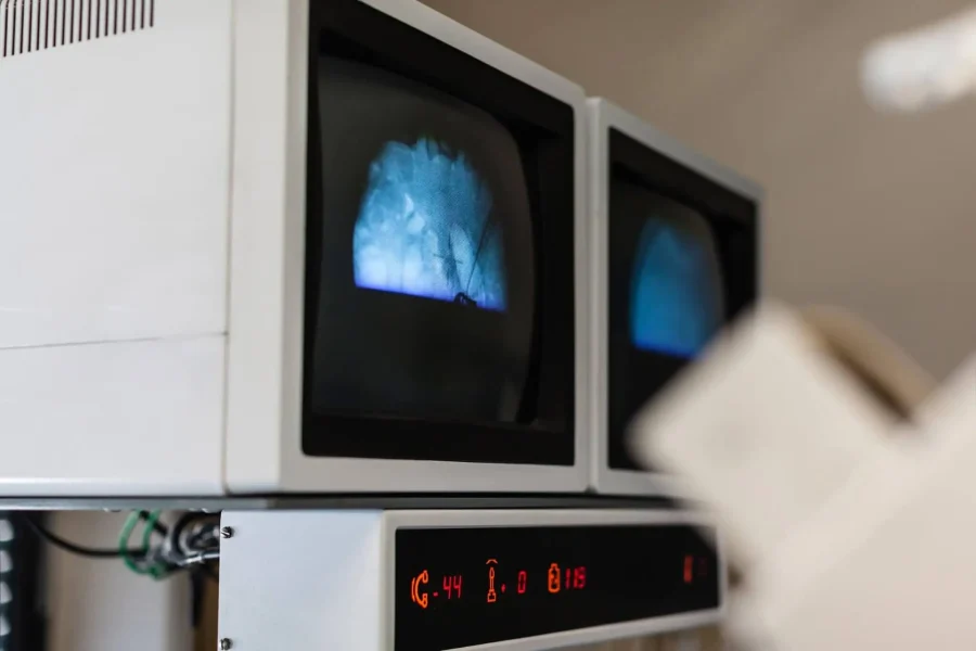 Διουρηθρική Laser Κυστεολιθοτριψία