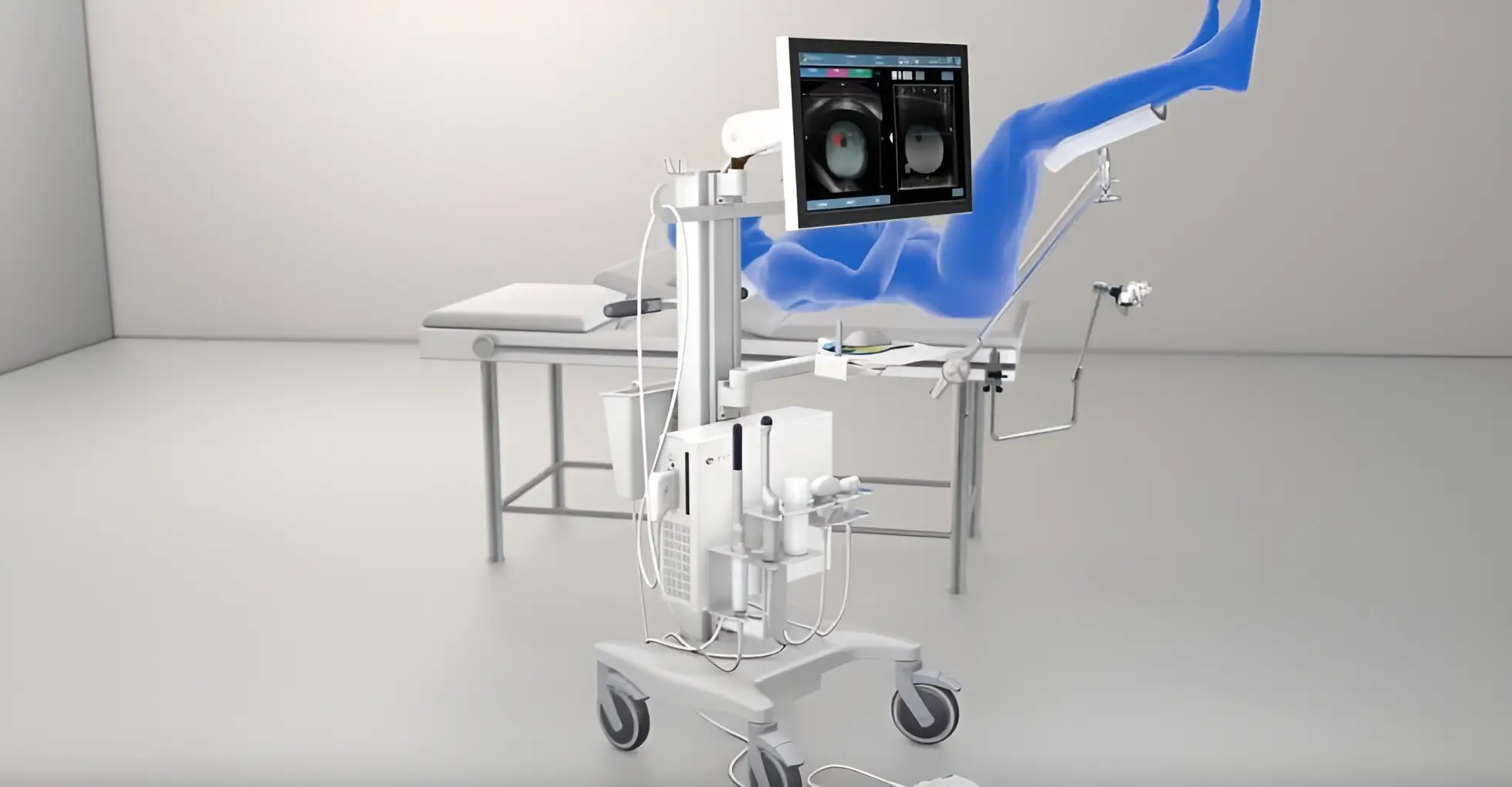 Κατευθυνόμενη βιοψία προστάτη Elastic Fusion στο Therapis General Hospital